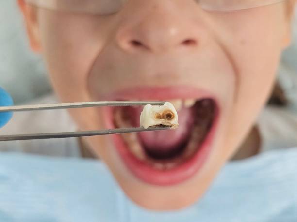 Best Emergency Dental Care for Abscessed Tooth in Faison, NC